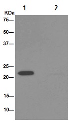 Immunoprecipitation analysis of MDA-MB-435 cell lysate labeling NDUFAF4 using ab191414 at 1/90 dilution (Lane 1). An Anti-Rabbit IgG (HRP), specific to the non-reduced form of IgG at 1/1500 was used as secondary antibody. Lane 2: PBS instead of MDA-MB-435 cell lysate.