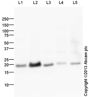 All lanes : Anti-NDUFB8 antibody (ab134367) at 1 µg/mlLane 1 : Heart (Human) Tissue Lysate - adult normal tissue (ab29431)Lane 2 : Human Heart Mitochondrial LysateLane 3 : Heart (Mouse) Tissue LysateLane 4 : Skeletal Muscle (Human) Tissue Lysate - adult normal tissue (ab29330)Lane 5 : Skeletal Muscle (Mouse) Tissue LysateLysates/proteins at 10 µg per lane.SecondaryGoat Anti-Rabbit IgG H&L (HRP) (ab97051) at 1/10000 dilutiondeveloped using the ECL techniquePerformed under reducing conditions.