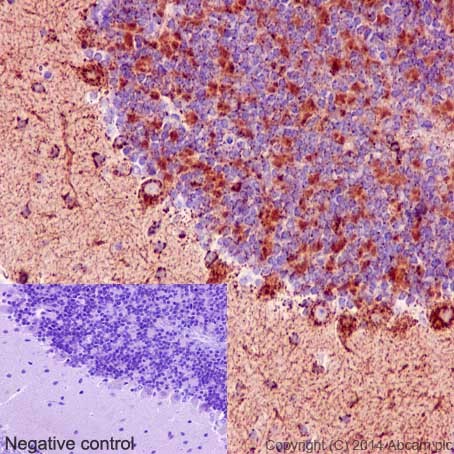 Immunohistochemical analysis of paraffin-embedded Mouse brain tissue labeling NDUFB8 with ab192878 at 1/500 dilution followed by pre-diluted HRP Polymer for Rabbit/Mouse IgG. Counter stained with Hematoxylin.