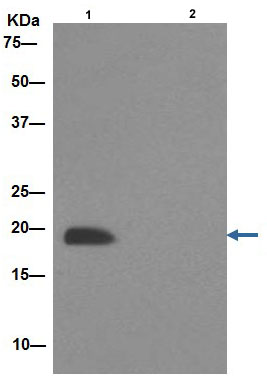 Western blot analysis of NDUFB8 immunoprecipitated from Human fetal heart lysate using ab192878 at 1/20 dilution. Lane 1: Human fetal liver lysate. Lane 2: PBS instead of Human fetal liver lysate.Secondary: Anti-Rabbit IgG (HRP), specific to the non-reduced form of IgG at 1/1500 dilution.Blocking/Dilution buffer: 5% NFDM/TBST.