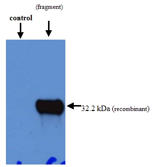 All lanes : Anti-Ndufs1 antibody (ab52690) at 1/1000 dilutionLane 1 : The negative control lane: ~20ug of a total protein extract from E coli ~50ng to 100 ng of a recombinant fusion protein of an irrelevant antigen.Lane 2 : Test lane: ~20ug of a total protein extract from E coli with ~50ng to 500ng of the antigen (recombinant fusion protein). SecondaryRabbit anti-mouse IgG + IgM, (H+L) horseradish peroxidase conjugated at 1/5000 dilution