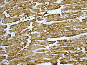 Immunohistochemical analysis of paraffin embedded Human cardiac muscle tissue labeling Ndufs1 with ab169540 antibody at 1/50.