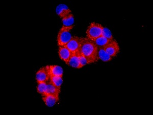 Immunofluorescent analysis of HepG2 cells labeling Ndufs1 with ab169540 at 1/100.