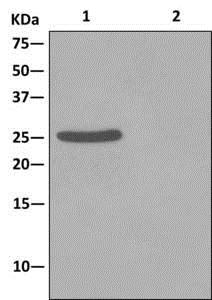 Western blot analysis on immunoprecipitation pellet from (1) fetal heart lysate or (2) 1XPBS (negative control) using ab177471at 1/10 dilution, and HRP-conjugated anti-rabbit IgG preferentially detecting the non-reduced form of rabbit IgG.