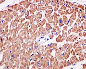 Immunohistochemcal analysis of paraffin-embedded Human heart tissue labeling NDUFS3 with ab177471 at 1/50 dilution.