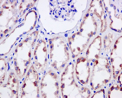Immunohistochemcal analysis of paraffin-embedded Human kidney tissue labeling NDUFS3 with ab177471 at 1/50 dilution.