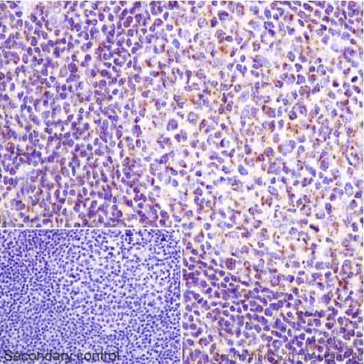 Immunohistochemical analysis of paraffin-embedded Human tonsil tissue labeling NDUFS6 with ab195807 at 1/500. Secondary antibody: Goat Anti-Rabbit IgG H&L (HRP) (ab97051) at 1/500. Inset image: negative control obtained using PBS instead of ab195807 and secondary antibody only.Note: Cytoplasm staining on human tonsil tissue was observed.