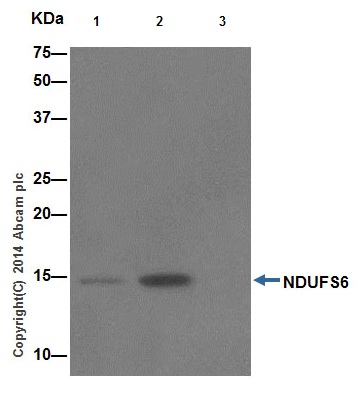 Immunoprecipitation analysis of Human fetal kidney lysate labeling NDUFS6 using ab195807 at 1/30 dilution (Lane 2).Lane 3: IP using Rabbit monoclonal IgG (ab172730) ) instead of ab195807 in Human fetal kidney lysates.Lane 1: Input: 10 μg Human fetal kidney lysates.Subsequent WB detection was performed using ab195807 at 1/1000 dilution.An Anti-Rabbit IgG (HRP), specific to the non-reduced form of IgG at 1/1500 was used as secondary antibody.