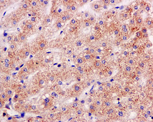Immunohistochemical analysis of paraffin-embedded Human liver tissue labeling NDUFS8 with ab170936 at 1/250 dilution.
