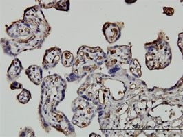 NEDD1 antibody (ab57336) used in immunohistochemistry at 5ug/ml on formalin fixed and paraffin embedded human placenta.