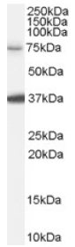 Anti-NEDD1 antibody (ab56317) at 0.1 µg/ml + HeLa cell lysate (in RIPA buffer) at 35 µg