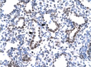 Paraffin embedded human lung tissue labelled with HEY1 antibody (ab22614) at 4-8µg/ml.  Magnification 400X.Alveolar cells are positively labelled (indicated with arrows).