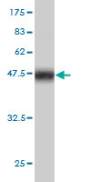 Western blot against tagged recombinant protein immunogen using ab57499 NEDL2 antibody at 1ug/ml.