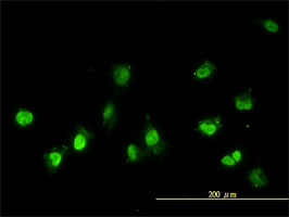 NEK11 antibody (ab57747) used in immunofluorescence at 10ug/ml on HeLa cells.