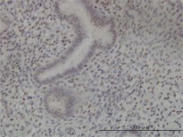 NEK11 antibody (ab57747) used in immunohistochemistry at 3ug/ml on formalin fixed and paraffin embedded human endometrium tissue.