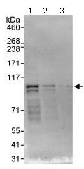 All lanes : Anti-NEK4 antibody (ab95176) at 0.04 µg/mlLane 1 : HeLa cell lysate at 50 µg/mlLane 2 : HeLa cell lysate at 15 µg/mlLane 3 : HeLa cell lysate at 5 µg/ml