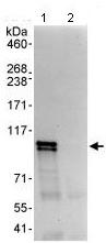 Immunoprecipitation of NEK4 from HeLa cell lysate (1mg) using ab95176 at 3µg/mg lysate , followed by Western blotting of 20% of the immunoprecipitate: (1) ab95176 at 1 µg/ml, (2) control IgGDetection: Chemiluminescence with exposure times of 30 seconds.