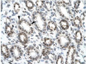 Paraffin embeded human kidney tissue labelled with HEY1 antibody (ab22614) at 4-8µg/ml. Magnification 400X. Epithelial cells of renal tubules are positively labelled (indicated with arrows).