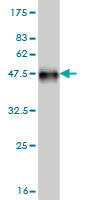 Western blot against tagged recombinant protein immunogen using ab58042 NEK5 antibody at 1ug/ml.