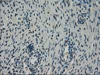 ab117986, at 1/50 dilution, staining NEK6 in paraffin-embedded Human ovary tissue by Immunohistochemistry.