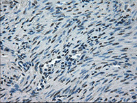 ab117986, at 1/50 dilution, staining NEK6 in paraffin-embedded Human endometrium tissue by Immunohistochemistry.