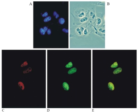 Immunofluoresence on MCF-7 cells transfected with human HMGA1a-GFP using ab4078.A: Hoechst stainB: PhasecontrastC: TexasRed HMG-I/HMG-Y (ab4078)D: HMGA1a-GFPE: Merge