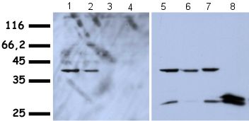 Lanes 1 - 4 :  Anti-HMGA1a / HMGA1b antibody - ChIP Grade (ab4078) at 1/1000 dilutionLanes 5 - 8 :  Anti-GFPLane 1 : Whole cell lysate from HepG2 cells transfected with plasmids coding for hHMGA1a GFP fusion proteins.Lane 2 : Whole cell lysate from HepG2 cells transfected with plasmids coding for hHMGA1b-GFP fusion proteinsLane 3 : Whole cell lysate from HepG2 cells transfected with plasmids coding for hHMGA2-GFP fusion proteinsLane 4 : hole cell lysate from HepG2 cells transfected with plasmids coding for NLS-GFP fusion proteinsLane 5 : Whole cell lysate from HepG2 cells transfected with plasmids coding for hHMGA1a-GFP fusion proteinsLane 6 : Whole cell lysate from HepG2 cells transfected with plasmids coding for hHMGA1b-GFP fusion proteinsLane 7 : Whole cell lysate from HepG2 cells transfected with plasmids coding for hHMGA2-GFP fusion proteinsLane 8 : Whole cell lysate from HepG2 cells transfected with plasmids coding for NLS-GFP fusion proteinsSecondaryAnti-rabbit HRP at 1/10000 di