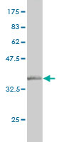 Western blot against tagged recombinant protein immunogen using ab55548 NELL1 antibody at 1ug/ml. 