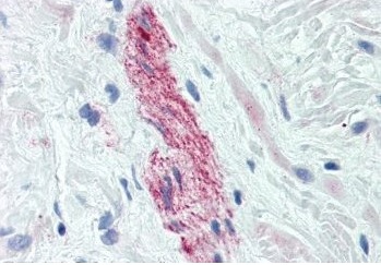 Immunohistochemistry of Anti-Nestin on formalin fixed paraffin embedded prostate nerve tissue using ab18102