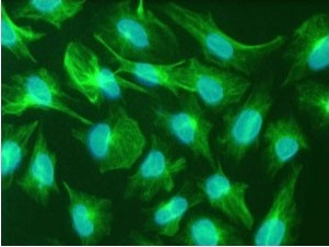 Immunofluorescence staining of U251 cells (glioblastoma cell line) stained using ab18102(green) and bisbenzimide (blue)