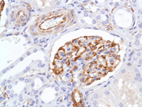 ab105389, at a 1/100 dilution, staining Nestin in formalin fixed, paraffin embedded Human kidney tissue by Immunohistochemistry.