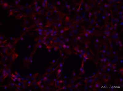 ab27952 staining rat astrocytes by ICC/IF.  Cells were PFA fixed and permeabilized in 0.5% Saponin prior to blocking in 10% serum for 1 hour at 20°C.  The primary antibody was diluted 1/500 and incubated with the sample for 18 hours at 4°C.  A Cy3® conjugated goat anti-rabbit IgG antibody diluted 1/400 was used as the secondary.See Abreview