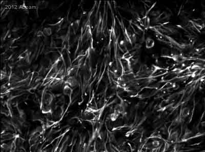 ab27952 staining Nestin in human embryonic stem cells by Immunocytochemistry/ Immunofluorescence.Cells were fixed in paraformaldehyde, permeabilized using Triton-X, blocked with 5% serum for 2 hours at 25°C and then incubated with ab27952 at a 1/100 dilution for 12 hours at 4°C. The secondary used was an Alexa-Fluor 488 conjugated donkey polyclonal used at a 1/500 dilution.See Abreview