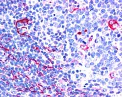ab5914 (2.5 µg/ml) staining NET1 in Human Tonsil by IHC-P.  Steamed antigen retrieval with citrate buffer pH 6, AP-staining.  This image shows staining of fibrous structures.