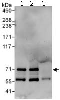 Immunoprecipitation of NET1 (6 µg of antibody per mg of Jurkat cell lysate; 20% of the IP loaded). Lane 1- Immunoprecipitation with an anti-Net1 antibody that recognizes an upstream epitope; Lane 2- Immunoprecipitation with ab113202; Lane 3- Immunoprecipitation with IgG control. Anti-Net 1 antibody (ab113202) used at 1 µg/ml for western blot. Detection: Chemiluminescence with exposure time of 3 min.