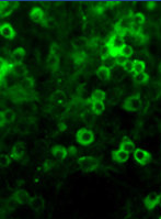 Dissociated cell cultures of an e13 mouse brain showing Netrin 1 (green staining) in neuronal precursor cells.