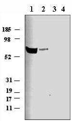 All lanes : Anti-Netrin 1 antibody (ab26162) at 1 µg/mlLane 1 : Mouse brain extract (Embryonic day 14)Lane 2 : Mouse brain extract (Embryonic day 16)Lane 3 : Mouse brain extract (Post natal day 1)Lane 4 : Mouse brain extract (Adult)Observed band size : 67 kDa (why is the actual band size different from the predicted?)