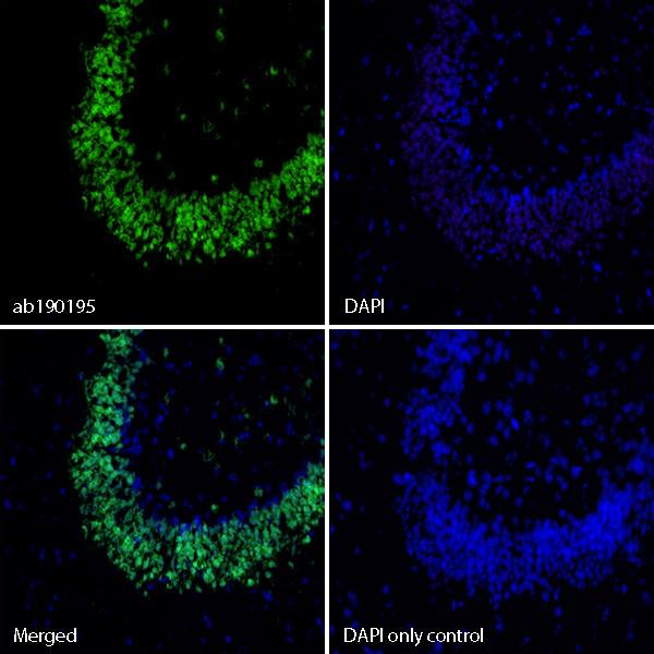IHC image of ab190195 staining in acetone fixed frozen tissue section of normal rat brain.The section was pre-treated using heat mediated antigen retrieval with sodium citrate buffer (pH6) in a Dako Pascal pressure cooker using the standard factory-set regime. Non-specific protein-protein interactions were then blocked using in TBS containing 0.025% (v/v) Triton X-100, 0.3M (w/v) glycine and 3% (w/v) BSA for 1h at room temperature. The section was then incubated with ab190195 (1/50) in TBS containing 0.025% (v/v) Triton X-100 and 3% (w/v) BSA overnight at +4°C. The section was then counterstained and mounted with SlowFade® Gold Antifade Mountant with DAPI.The DAPI only control (no antibody) inset shows no autoflourescence, demonstrating that any Alexa Fluor® 488 signal is dervied directly from bound ab190195. The separate images of ab190195 and DAPI alone, combined with the merged version of both signals, shows predominant co-localisation of the Alexa Fluor® 488 signal in the nuclei o