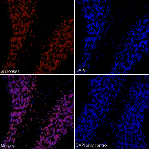 IHC image of ab190565 staining in formalin fixed paraffin embedded tissue section of normal human cerebellum.The section was pre-treated using heat mediated antigen retrieval with sodium citrate buffer (pH6) in a Dako Pascal pressure cooker using the standard factory-set regime. Non-specific protein-protein interactions were then blocked using in TBS containing 0.025% (v/v) Triton X-100, 0.3M (w/v) glycine and 3% (w/v) BSA for 1h at room temperature. The section was then incubated with ab190565 (1/50) in TBS containing 0.025% (v/v) Triton X-100 and 3% (w/v) BSA overnight at +4°C. The section was then counterstained and mounted with SlowFade® Gold Antifade Mountant with DAPI.The DAPI only control (no antibody) inset shows no autoflourescence, demonstrating that any Alexa Fluor® 647 signal is dervied directly from bound ab190565. The separate images of ab190565 and DAPI alone, combined with the merged version of both signals, shows predominant co-localisation of the Alexa Fluor® 647 sign