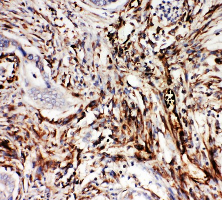 Immunohistochemical analysis of paraffin-embedded Rat Intestine Cancer Tissue labeling Neuregulin 1 beta 2 with ab191139 at 1 µg/ml.