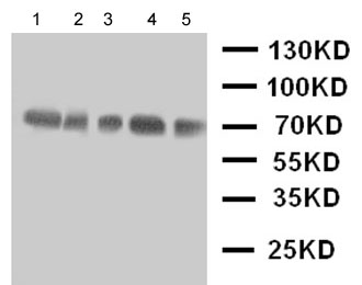 All lanes : Anti-Neuregulin 1 beta 2 antibody - N-terminal (ab191139) at 0.5 µg/mlLane 1 : Rat Spleen Tissue LysateLane 2 : Rat Kidney Tissue LysateLane 3 : Rat Brain Tissue LysateLane 4 : HeLa Cell LysateLane 5 : SMMC Cell Lysate