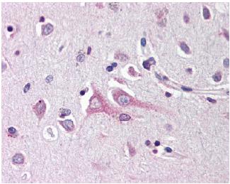 ab64186 (10ug/ml) staining Neuritin in human brain, cortex tissue by immunohistochemistry using formalin-fixed, paraffin-embedded tissue.