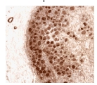 ab30325 at a 1/500 dilution, staining human Neurofibromin in human dorsal ganglion neurons by Immunohistochemistry, Formalin fixed Paraffin embedded tissue.