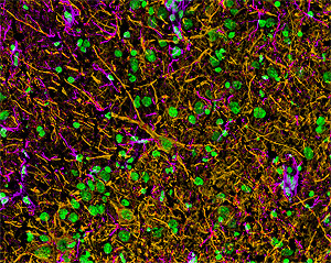 ab24575 at a 1/1000 dilution staining rat brain tissue sections (8um horizontal section)(orange) by Immunohistochemistry (frozen sections). Other structures visualized with anti-GFAP (violet) and Hoechst (green).