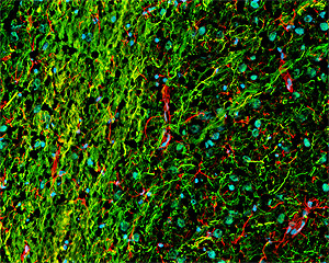 ab24574 at a 1/1000 dilution staining rat brain tissue sections (8um horizontal section)(green) by Immunohistochemistry (frozen sections). Other structures visualized with anti-GFAP (red) and Hoechst (blue).