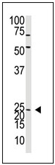 Anti-Neurogenin 2 antibody (ab38550) at 1/100 dilution + Mouse liver tissue lysate
