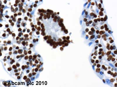 ab38548 (4µg/ml) staining Neurogenin-3 in human jejunum using an automated system (DAKO Autostainer Plus). Using this protocol there is strong nuclear staining.Sections were rehydrated and antigen retrieved with the Dako 3 in 1 AR buffer citrate pH6.1 in a DAKO PT link. Slides were peroxidase blocked in 3% H2O2 in methanol for 10 mins. They were then blocked with Dako Protein block for 10 minutes (containing casein 0.25% in PBS) then incubated with primary antibody for 20 min and detected with Dako envision flex amplification kit for 30 minutes. Colorimetric detection was completed with Diaminobenzidine for 5 minutes. Slides were counterstained with Haematoxylin and coverslipped under DePeX. Please note that, for manual staining, optimization of primary antibody concentration and incubation time is recommended. Signal amplification may be required.