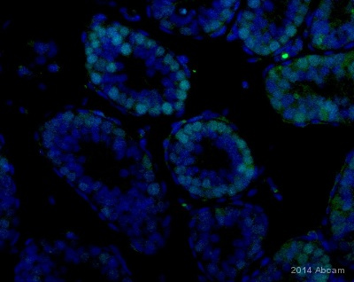 ab38548 staining Neurogenin3 in mouse psotnatal day 8 testes tissue sections by Immunohistochemistry (IHC-P - paraformaldehyde-fixed, paraffin-embedded sections). Tissue was fixed with 4$ paraformaldehyde and blocked with 5% BSA for 1 hour at 25°C; antigen retrieval was by heat mediation in 0.1M citric acid/sodium citrate. Samples were incubated with primary antibody (1/200) for 1 hour at 25°C. A FITC-conjugated donkey anti-rabbit IgG polyclonal (1/200) was used as the secondary antibody.See Abreview