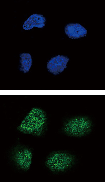 Immunocytochemistry/Immunofluorescence analysis of NCI-H460 cells labelling Neurogenin3 (green) with ab38548. An Alexa Fluor® 488-conjugated goat anti-rabbit IgG was used as the secondary antibody. Counterstained with DAPI (blue)