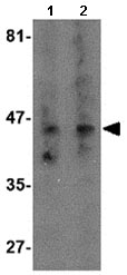 Lane 1 :  Anti-Neurokinin 3 Receptor NK3 antibody (ab124025) at 0.5 µg/mlLane 2 :  Anti-Neurokinin 3 Receptor NK3 antibody (ab124025) at 2 µg/mlLane 1 : RAW 264.7 whole cell lysateLane 2 : RAW 264.7 whole cell lysate